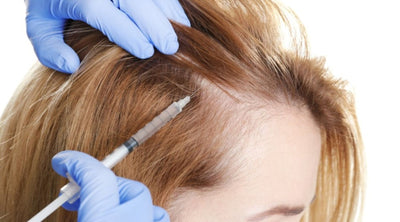 حقن البلازما للشعر - تعرفي على أحدث أساليب علاج تساقط الشعر