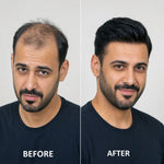 Men’s Wig Hair with French Lace in Body with Skin