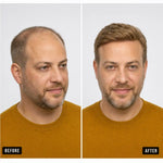 Men’s Wig Hair with French Lace in Body with Skin