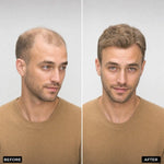 Men’s Wig Hair with French Lace in Body with Skin
