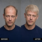 Men’s Wig Hair with French Lace in Body with Skin