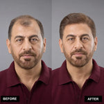 Men’s Wig Hair with French Lace in Body with Skin