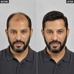 Men’s Wig Hair with French Lace in Body with Skin