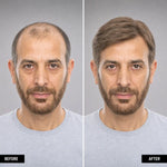 Men’s Wig Hair with French Lace in Body with Skin