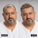 Men’s Wig Hair with French Lace in Body with Skin