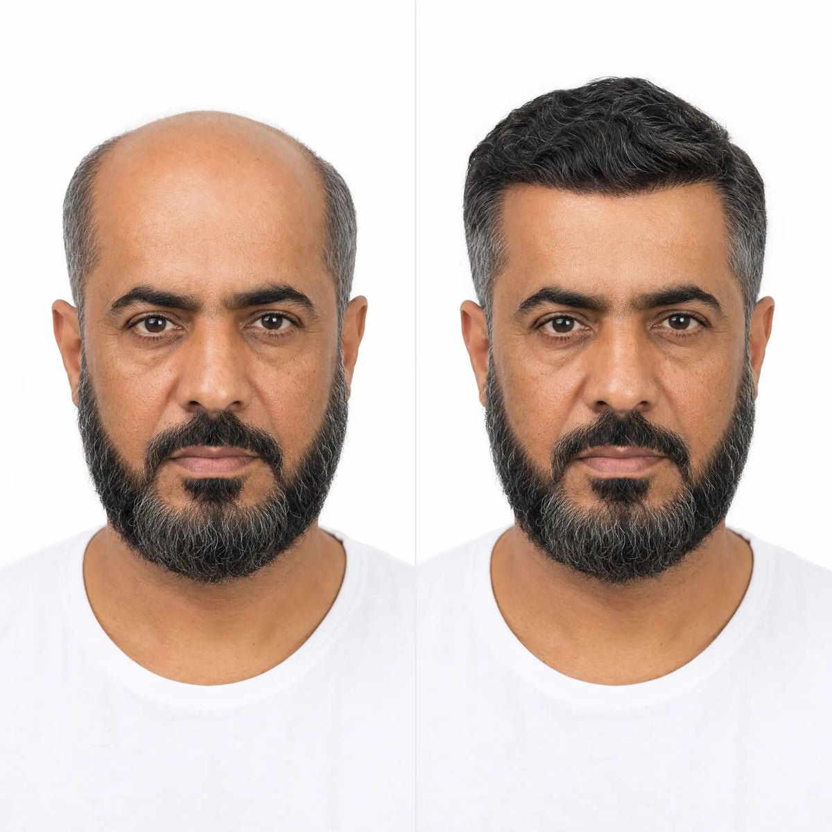 باروكة شعر طبيعي للرجال المونو
