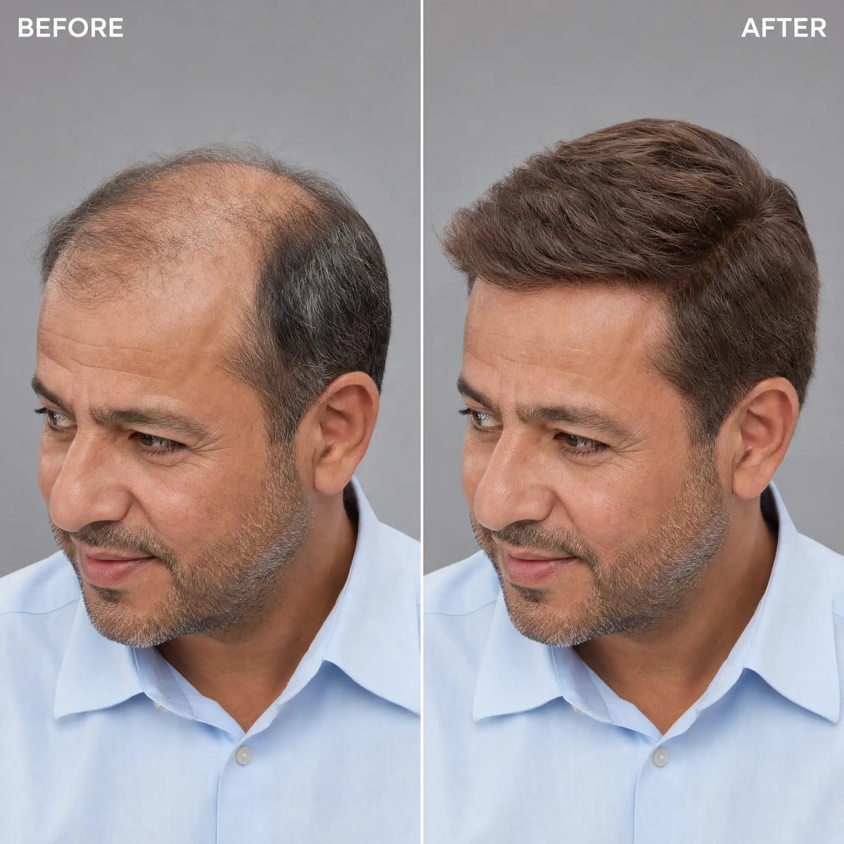 Men’s Wig Hair with French Lace in Body with Skin