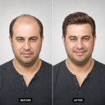 Men’s Wig Hair with French Lace in Body with Skin
