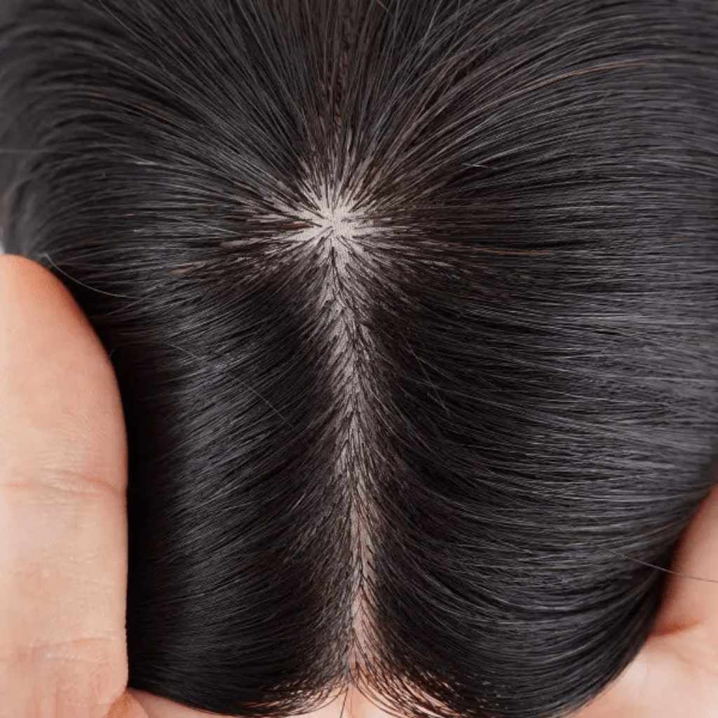 Silk Base Hair Topper – 100% Remy Hair for Natural Coverage and Volume