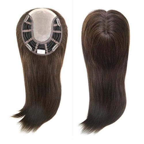 تغطية مقدمة الشعر في الرياض